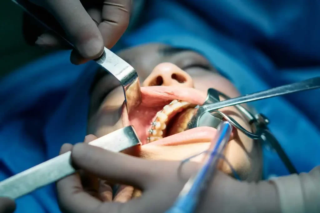 Tipos de cirugía maxilofacial