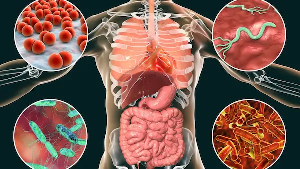 enfermedades causadas por bacterias concepto infecciones bacterianas salud humana sistema inmunológico