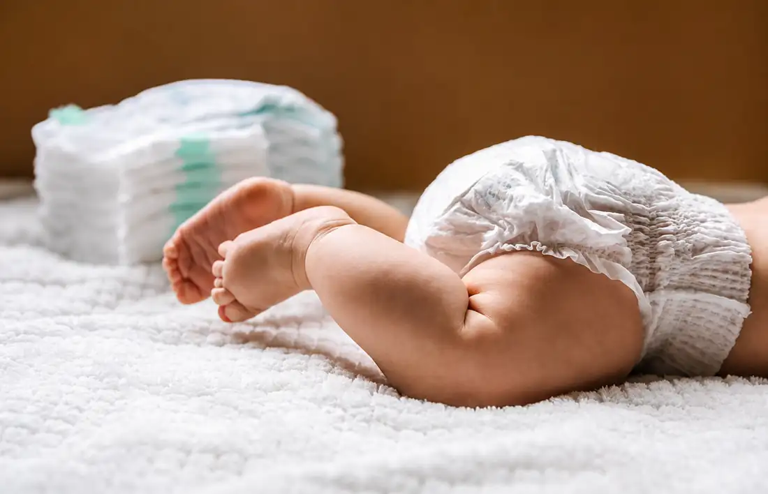 Cómo aliviar las escaldaduras en los bebés