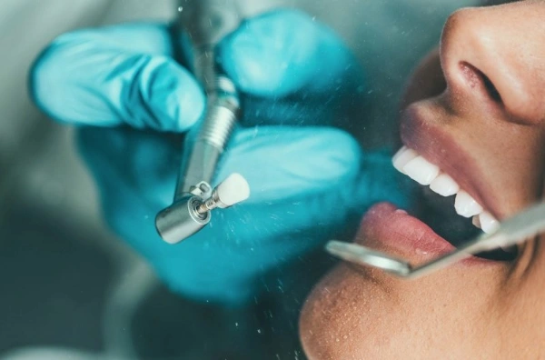 Cómo eliminar la placa bacteriana y prevenir su aparición