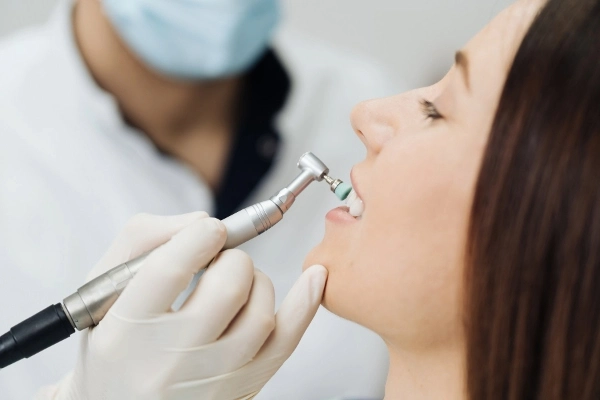 Mitos comunes sobre la placa bacteriana